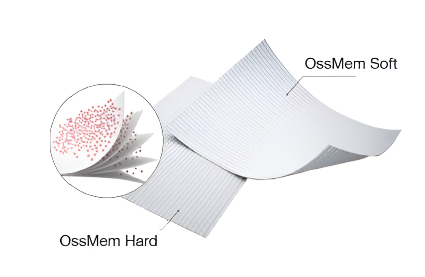 Ossmem uvod.png